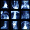 UCSF Imaging: Core and Extremities 2024 (Videos + Slides)