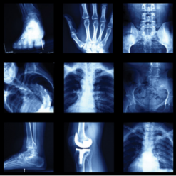 UCSF Imaging: Core and Extremities 2024 (Videos + Slides)
