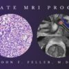 2021 Prostate MRI (Program 1) – John F. Feller, M.D