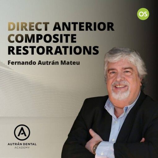 Osteocom – Direct Anterior Composite Restoration