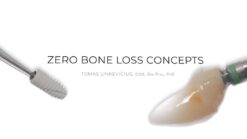 Zero Bone Loss Lab Zero Bone Loss Concepts Course