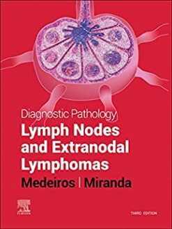 Diagnostic Pathology: Lymph Nodes and Extranodal Lymphomas, 3rd Edition (Original PDF from Publisher)