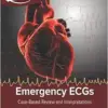Emergency ECGs: Case-Based Review and Interpretations (EPUB)