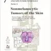 Nonmelanocytic Tumors of the Skin