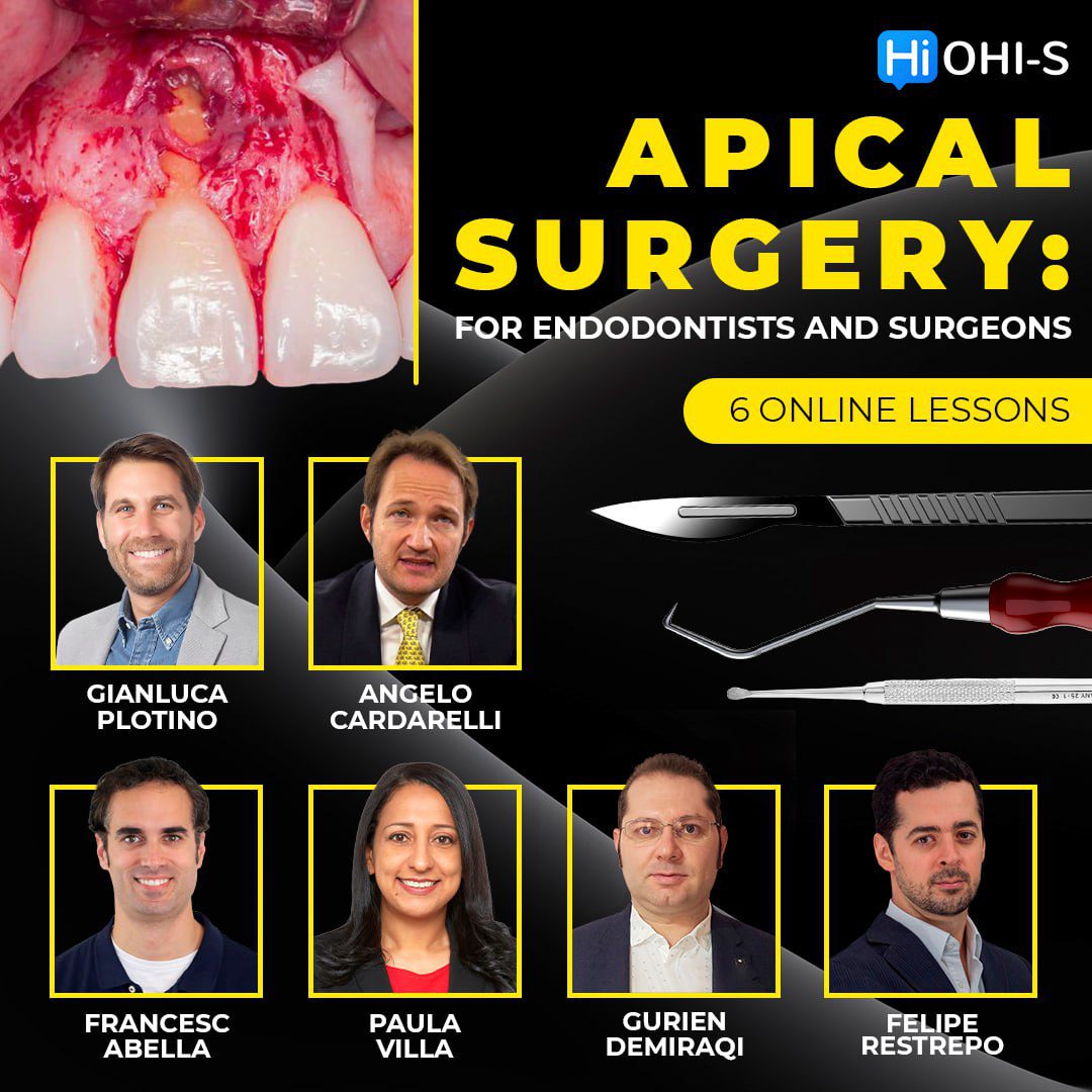 OHI-S – Apical Surgery For Endodontists and Surgeons
