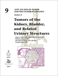 Tumors of the Kidney, Bladder, and Related Urinaray Structures