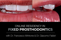 gIDE Institute Online Certificate Program in Fixed Prosthodontics – Esthetic and Functional Rehabilitation of Natural Teeth