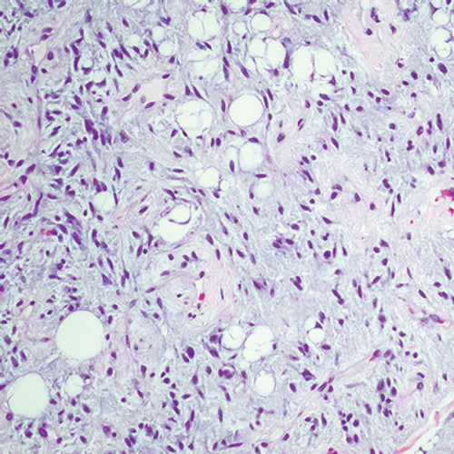 Cleveland Clinic Comprehensive and Immersive Soft Tissue Pathology 2025