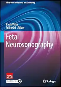 Fetal Neurosonography (Ultrasound in Obstetrics and Gynecology) (Original PDF from Publisher)