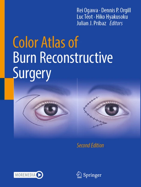 Color Atlas of Burn Reconstructive Surgery (PDF)