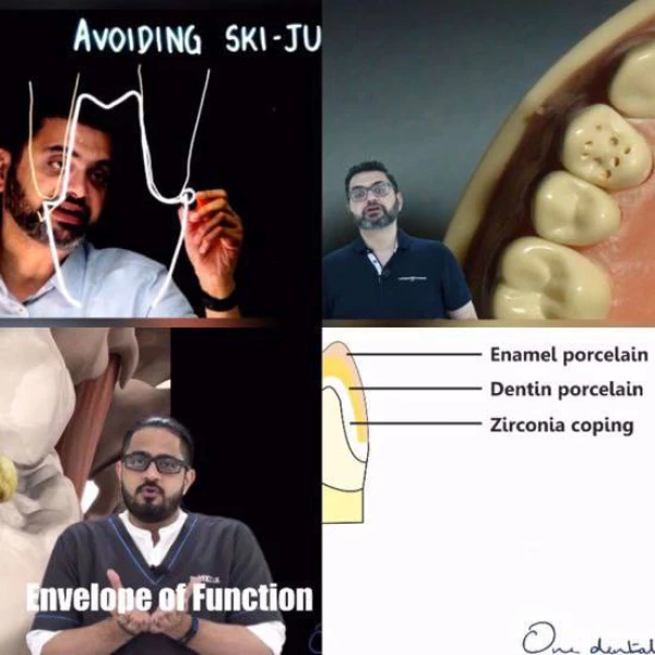 Everyday Fixed Prosthodontics: Certificate Course
