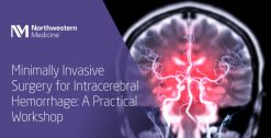 Northwestern Medicine Minimally Invasive Surgery for Intracerebral Hemorrhage A Practical Workshop 2025