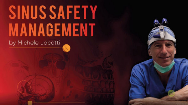 Osteocom Sinus Safety Management