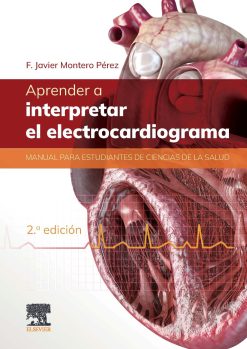 Aprender a interpretar el electrocardiograma