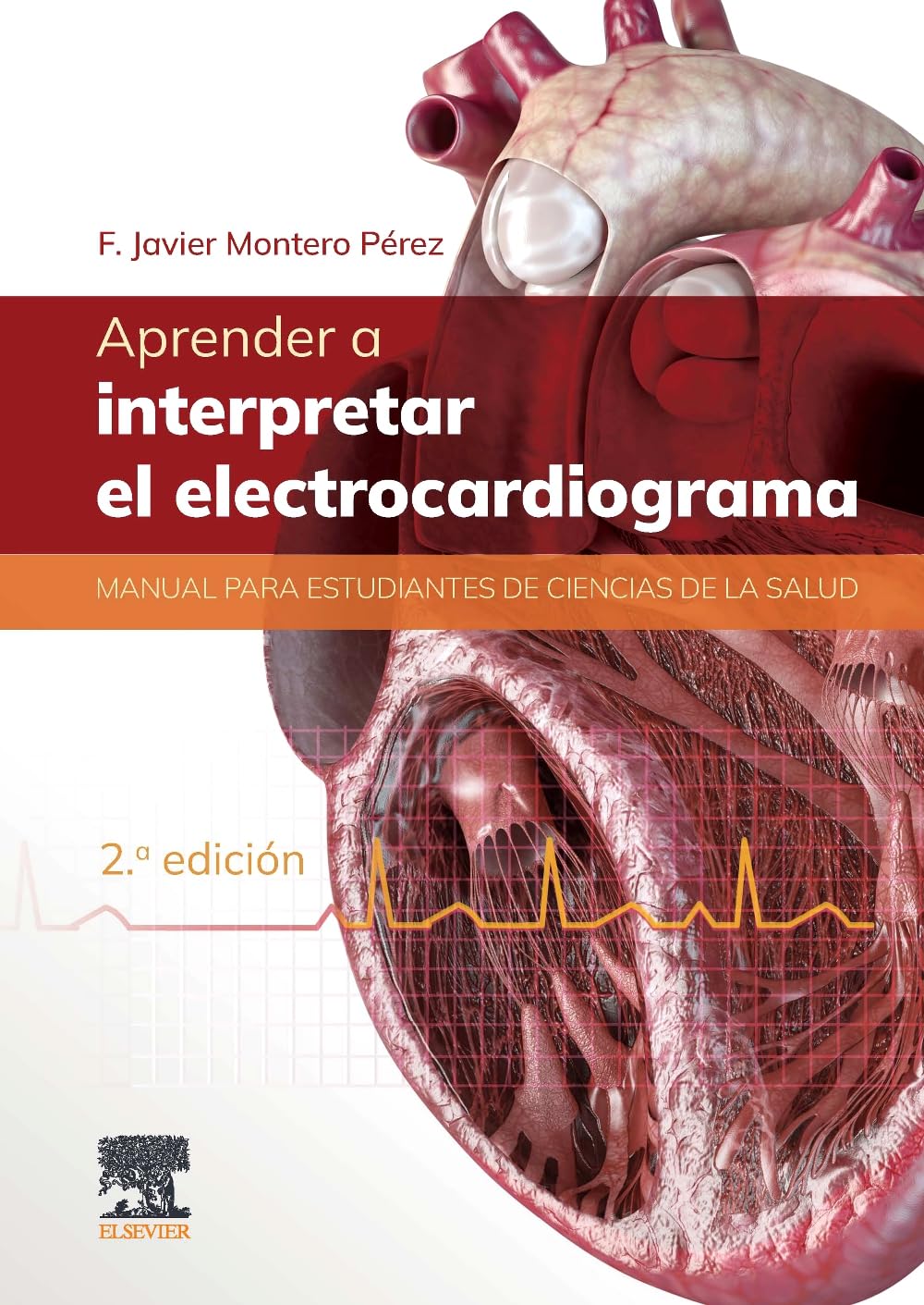 Aprender a interpretar el electrocardiograma