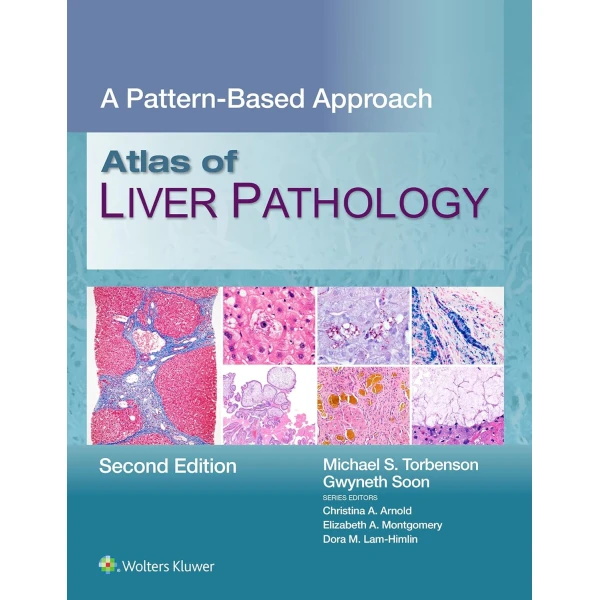 Atlas of Liver Pathology: A Pattern-Based Approach, 2nd Edition (EPUB)