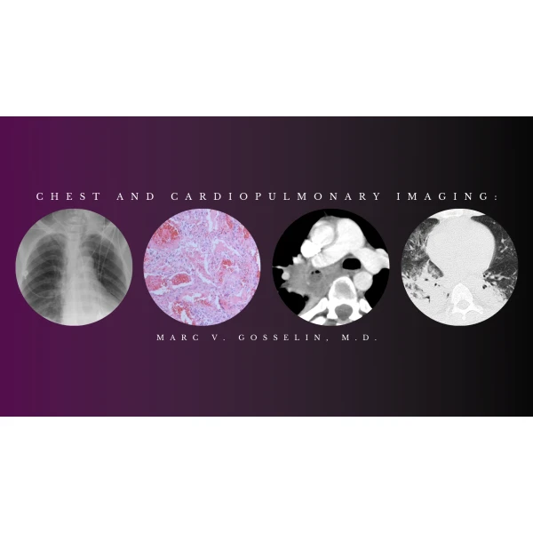 CMEScience Chest and Cardiopulmonary Imaging – Marc V. Gosselin, M.D (Videos + PDF)
