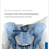 Fractures of the Pelvis and Acetabulum