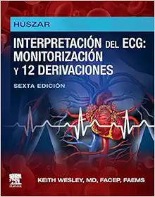 Huszar Interpretación del ECG