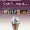 Master Techniques in Orthopedic Surgery: Knee Arthroplasty, 4th Edition (Original PDF from Publisher)