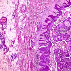 Oakstone Dermatopathology 2025