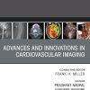 Advances and Innovations in Cardiovascular Imaging, An Issue of Radiologic Clinics of North America (True PDF from Publisher)