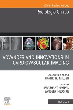 Advances and Innovations in Cardiovascular Imaging, An Issue of Radiologic Clinics of North America (True PDF from Publisher)