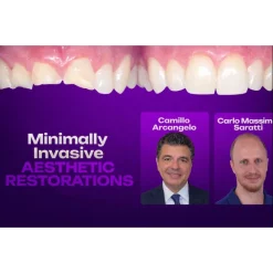 OHI-S Minimally Invasive Aesthetic Restorations: Additive, Digital, and Fully Functional Rehabilitation