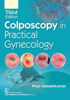 Colposcopy in Practical Gynecology, 3rd edition (Original PDF from Publisher)
