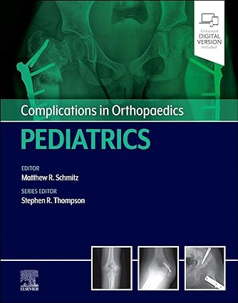 Complications in Orthopaedics: Pediatrics (Original PDF from Publisher)