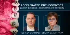 OHI-S Accelerated orthodontics Baruti-Demiraqi corticotomy protocol
