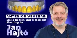 OHI-S Anterior Veneers Smile Design and Treatment Planning by Jan Hajtó