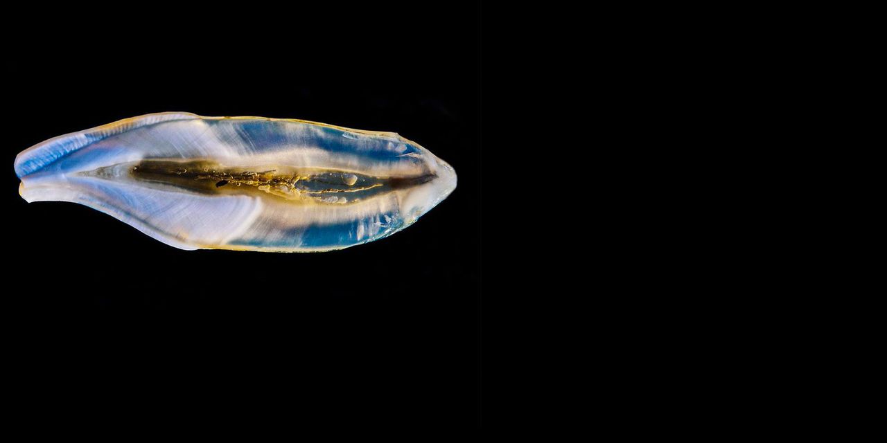 OHI-S Ceramic restorations