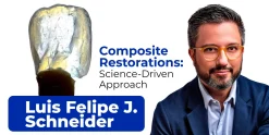 OHI-S Composite Restorations Science-Driven Approach