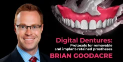 OHI-S Digital Dentures Protocols for removable and implant-retained prostheses