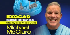 OHI-S EXOCAD Implant Restorations Step-by-step Video Guide