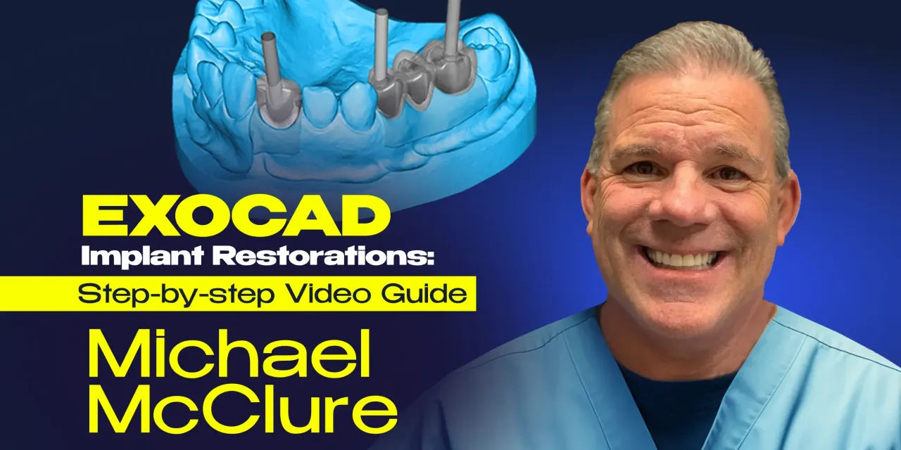 OHI-S EXOCAD Implant Restorations Step-by-step Video Guide