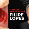 OHI-S Flapless implantology protocols for immediate implant placement and loading