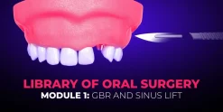 OHI-S Library of Oral Surgery. Module 1 GBR and Sinus Lift