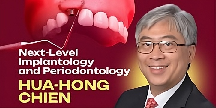 OHI-S Next-Level Implantology and Periodontology Mastering Immediate Implantation, Peri-implant Soft Tissue Augmentation, Sinus Lifting