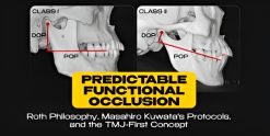 OHI-S Predictable Functional Occlusion Roth Philosophy, Masahiro Kuwata’s Protocols, and the TMJ-First Concept