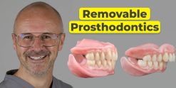 OHI-S Removable Prosthodontics Enhancing Function and Aesthetics