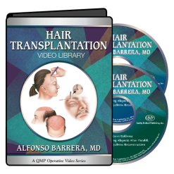 QMP Hair Transplantation 2017