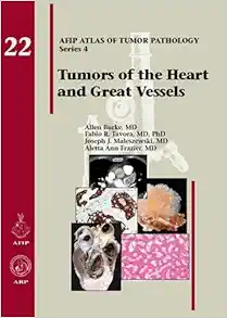 Tumors of the Heart and Great Vessels (AFIP Atlas of Tumor Pathology, Series 4, 22) (Original PDF from Publisher)