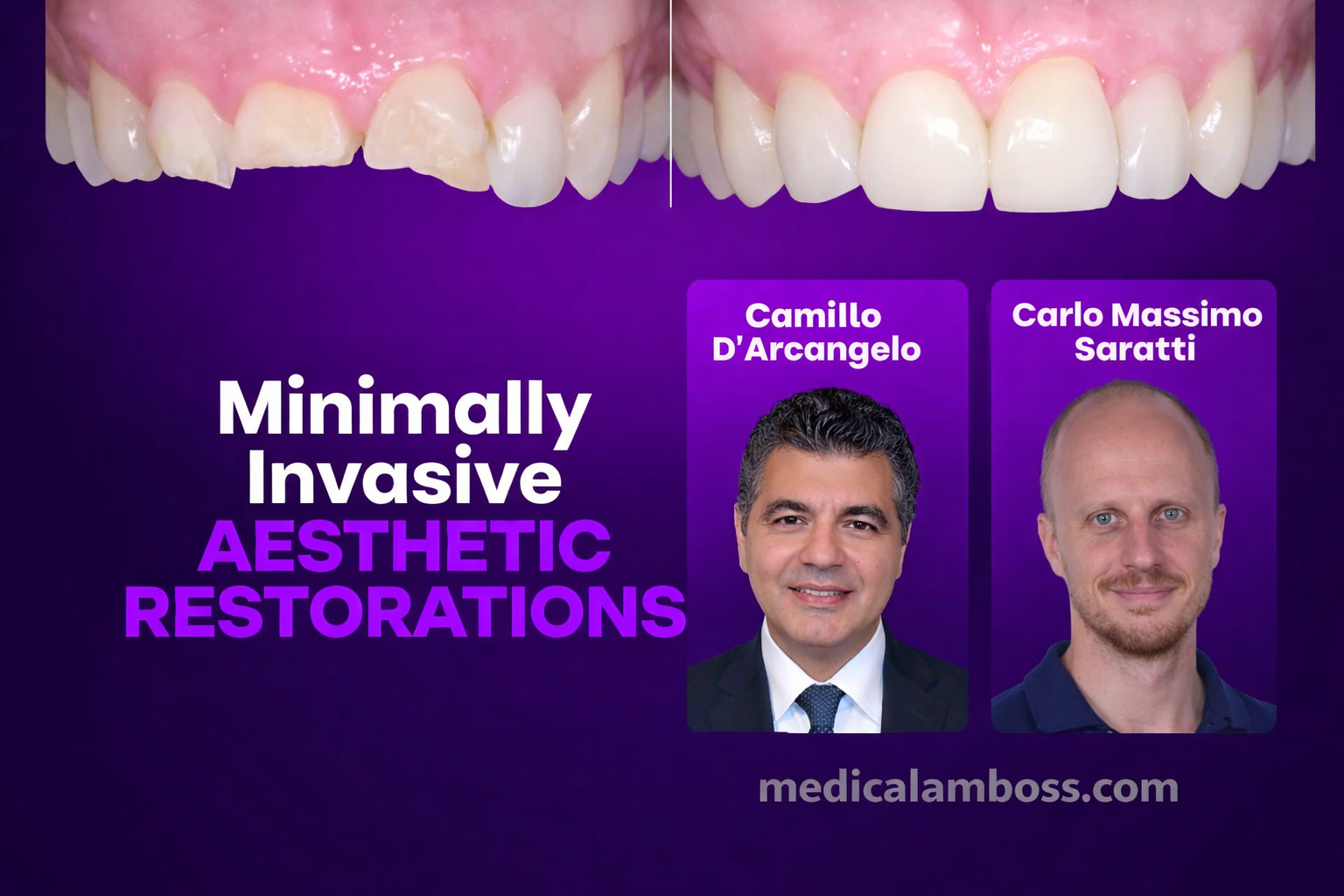 OHI-S Minimally Invasive Aesthetic Restorations Additive, Digital, and Fully Functional Rehabilitation