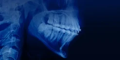 OHI-S Orthodontic treatment in patients with periodontal and alveolar bone pathology