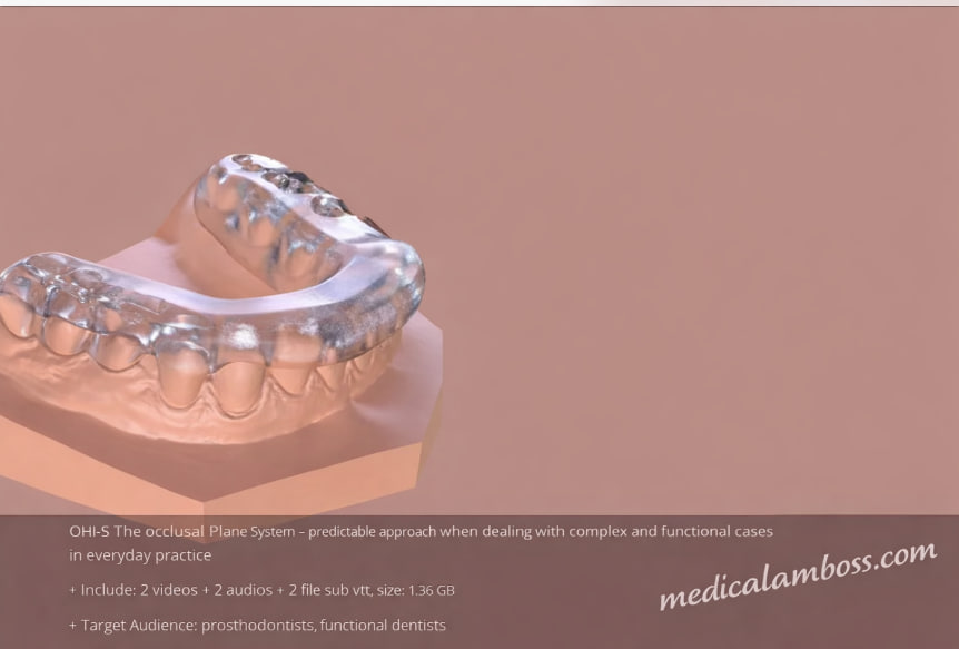 OHI-S The occlusal Plane System – predictable approach when dealing with complex and functional cases in everyday practice
